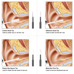 Wifi Otoscope 3 in 1 Ear Wax Remover Tool 720P vedenpitävä kamera 6 säädettävällä LEDillä yhteensopiva Android- ja iOS-järjestelmien kanssa