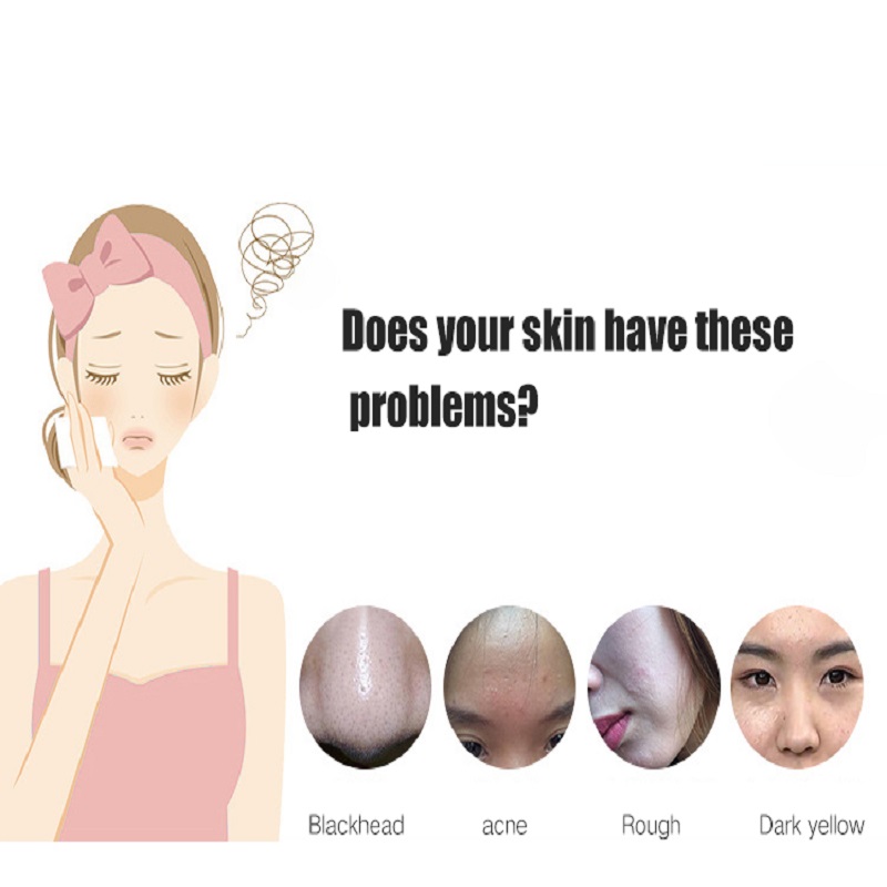 Deep Cleansing Exfoliators Skin Rejuvenation Face Lift kasvojen ultraääninen ihon pesuri